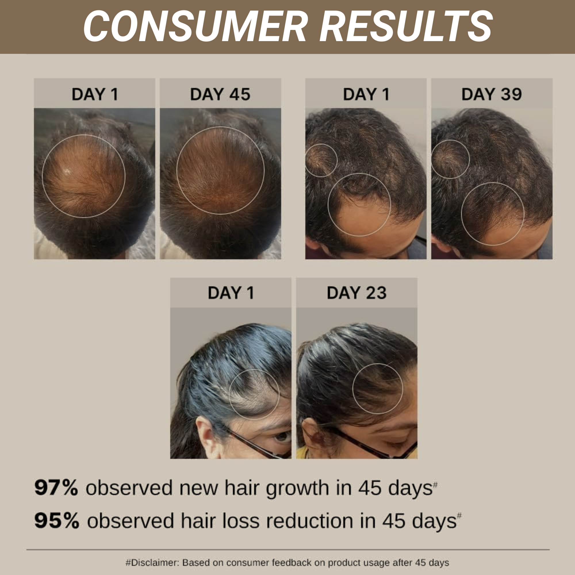 Anti Gravity Hair Growth Serum 2.0